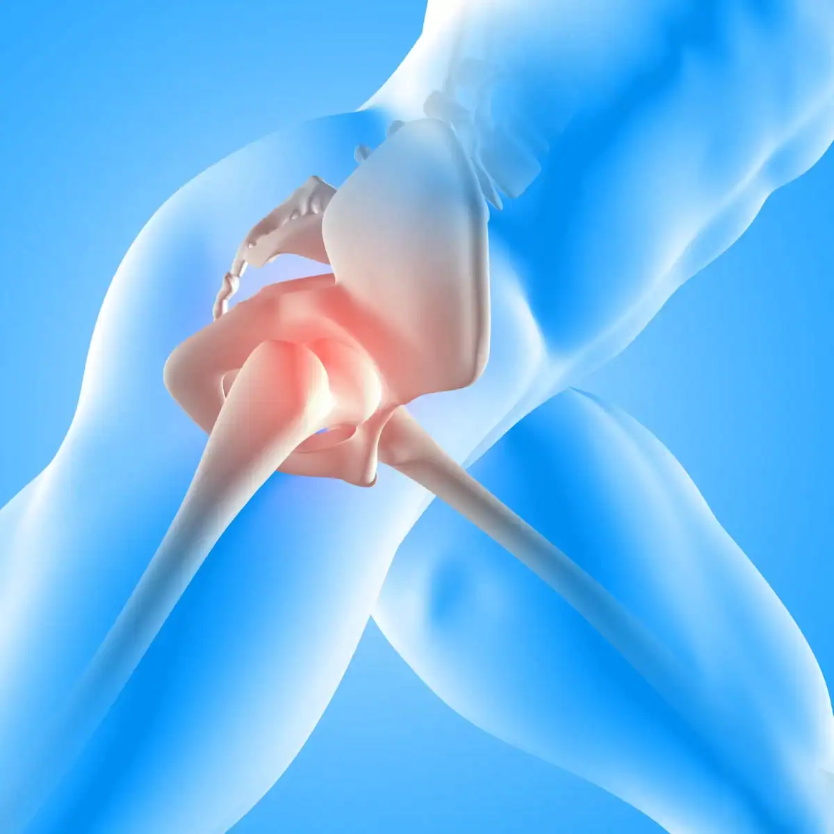 Detailed illustration of hip joint with pain focus for treatment options.