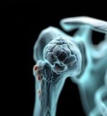Detailed medical illustration of shoulder joint and bones for pain treatment.